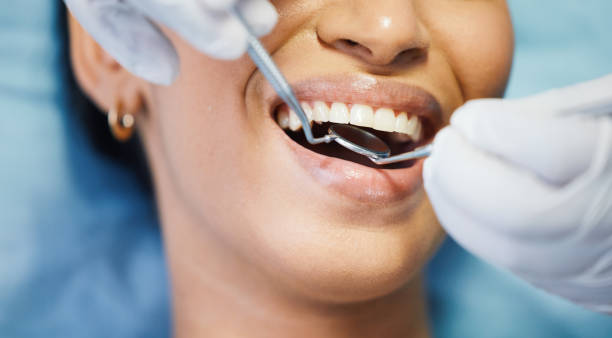 Best After-Hours Emergency Dentist in Winlock, WA